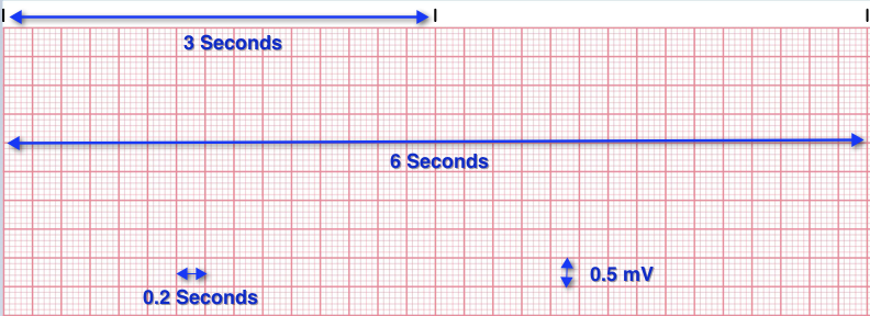 EKG-grid1