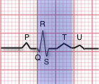 EKG-Qtinterval