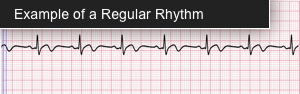 EKG-regular